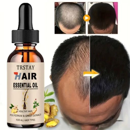 Last Day Of Discount 🔥 Ginger Hair Growth Oil
